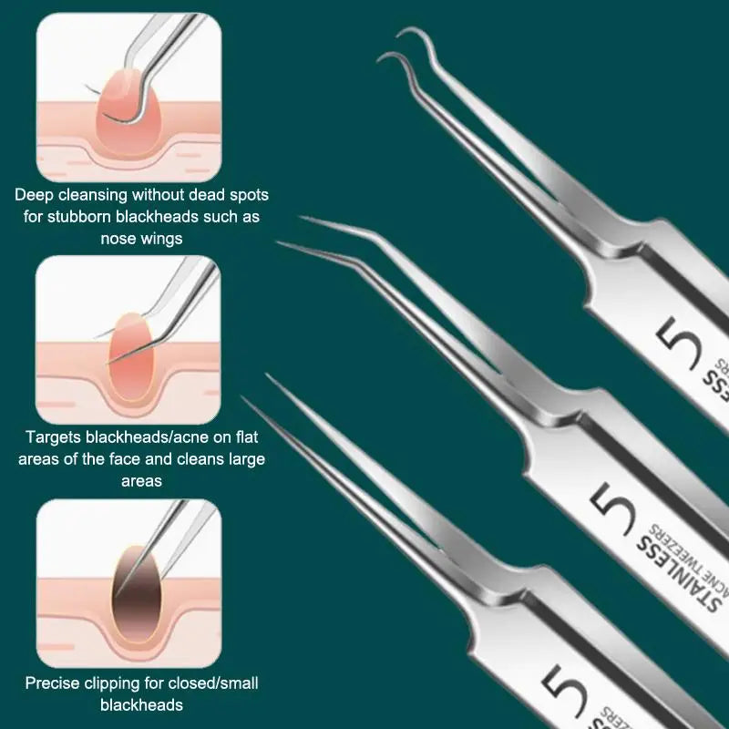 Blackhead Remover Tool Kit